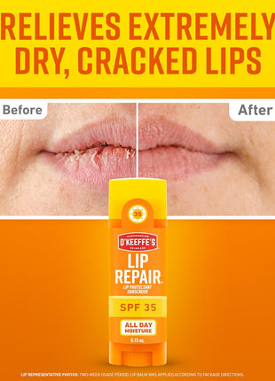 Lip Repair SPF 35 Lip Balm - Stick (3 Pack) - Sun-Safe Moisturizer for Extremely Cracked, Dry Lips