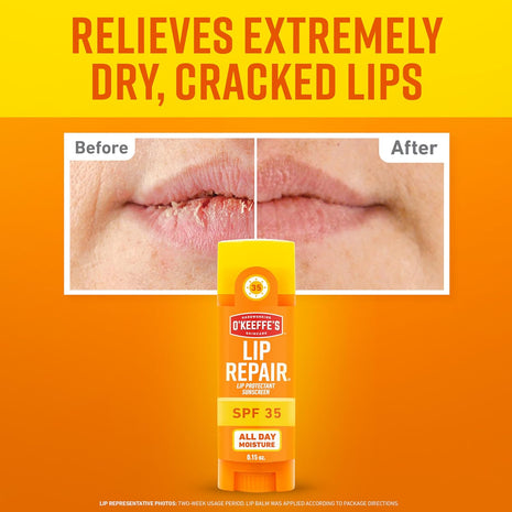 Lip Repair SPF 35 Lip Balm - Stick (3 Pack) - Sun-Safe Moisturizer for Extremely Cracked, Dry Lips